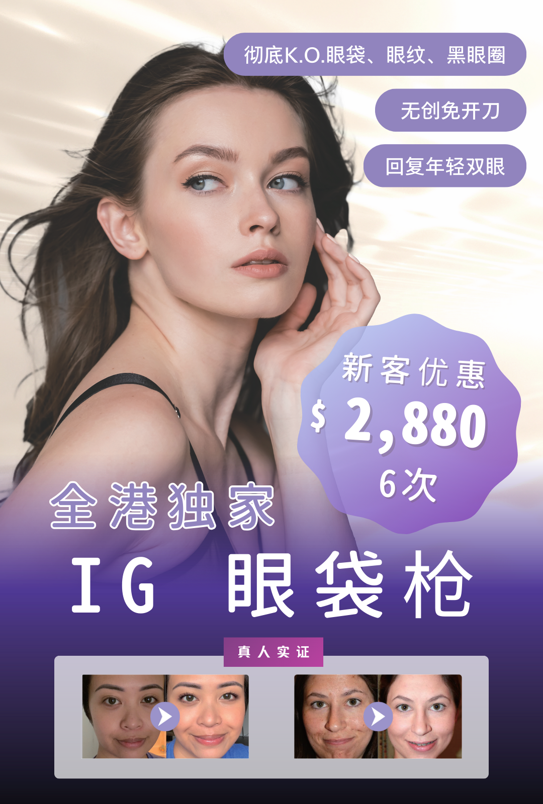 IG 眼袋枪