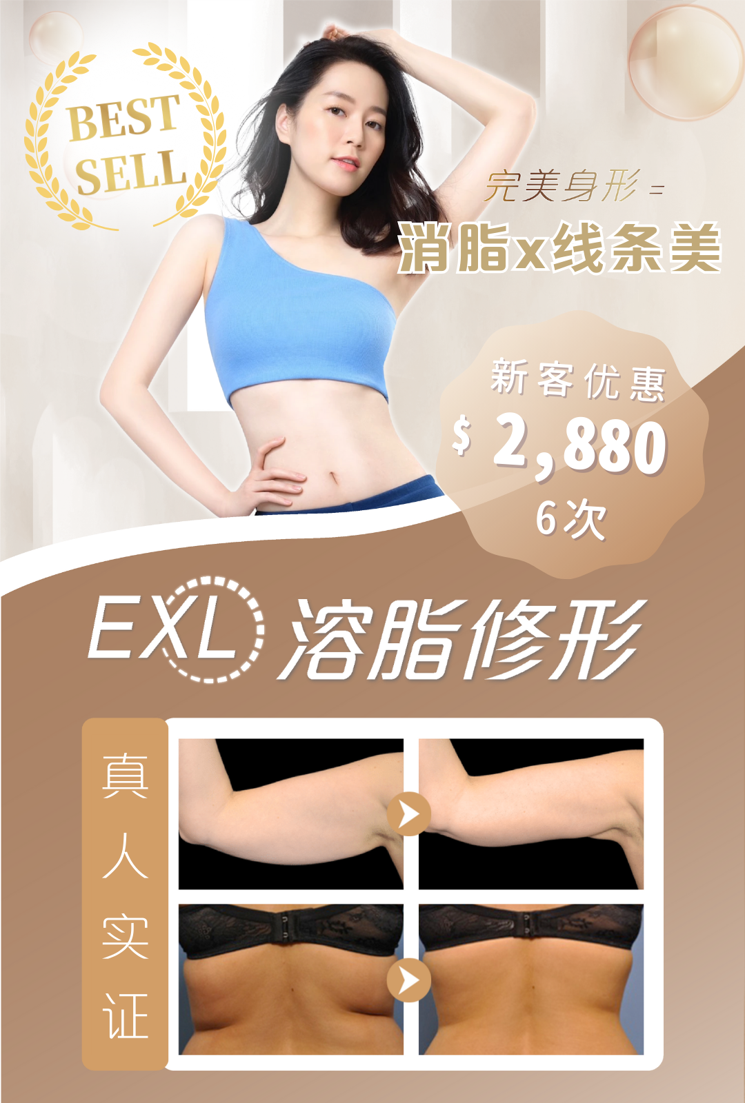 EXL 溶脂修形